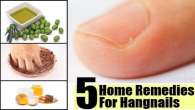 Hangnail pearls