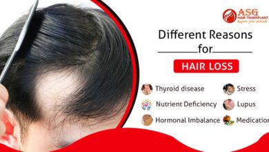 Can thyroid disorder cause hair loss