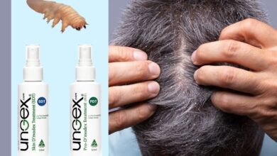 Can dandruff make your hair thin expert tells