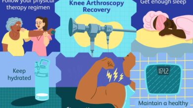 Knee arthroscopy recovery and exercise guide