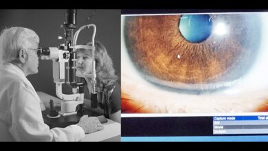 Doctors perform groundbreaking cataract surgery on thirty one week old premature baby