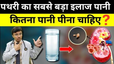 How much water to drink daily to pass kidney stones naturally