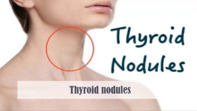 Thyroid nodules treatment diagnosis gland aware things