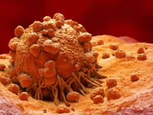 Quand le cancer parvient à pirater le système immunitaire et le retourner contre lui