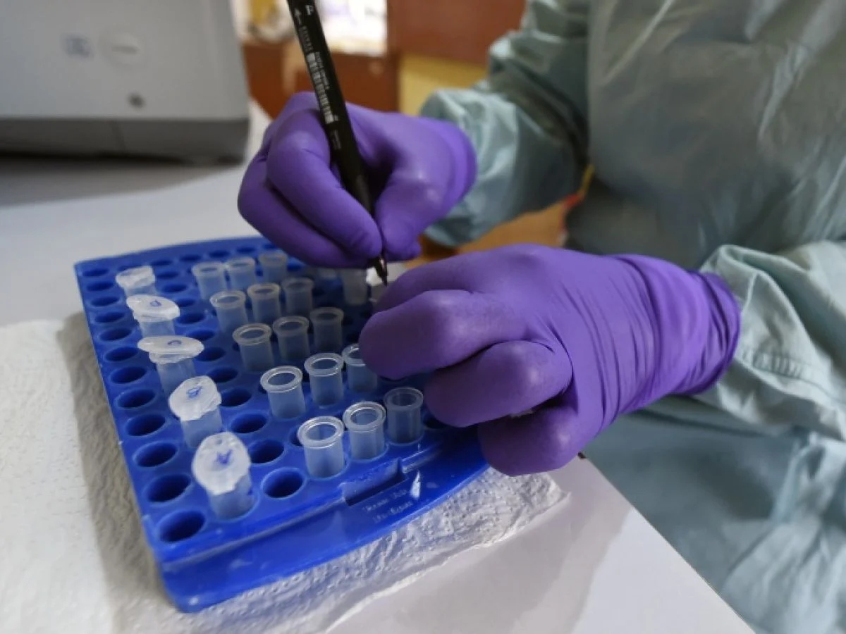 Nigeria Confronts Rare Bundibugyo Ebola Strain as Africa CDC Warns of Continental Emergency
